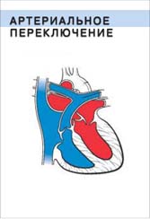 Артериальное переключение - операция по устранению порока сердца ТМА